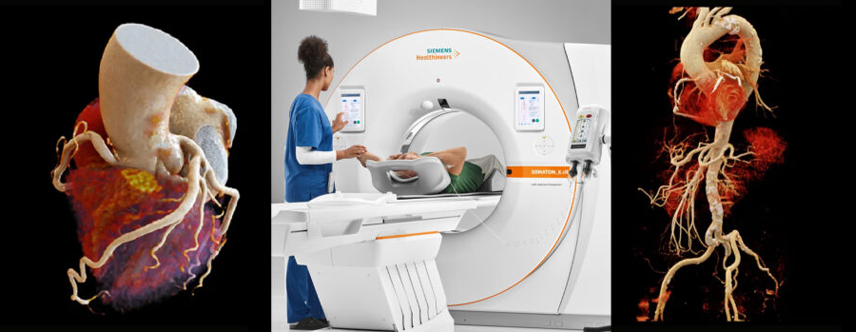 Coronary CT Angiography exam