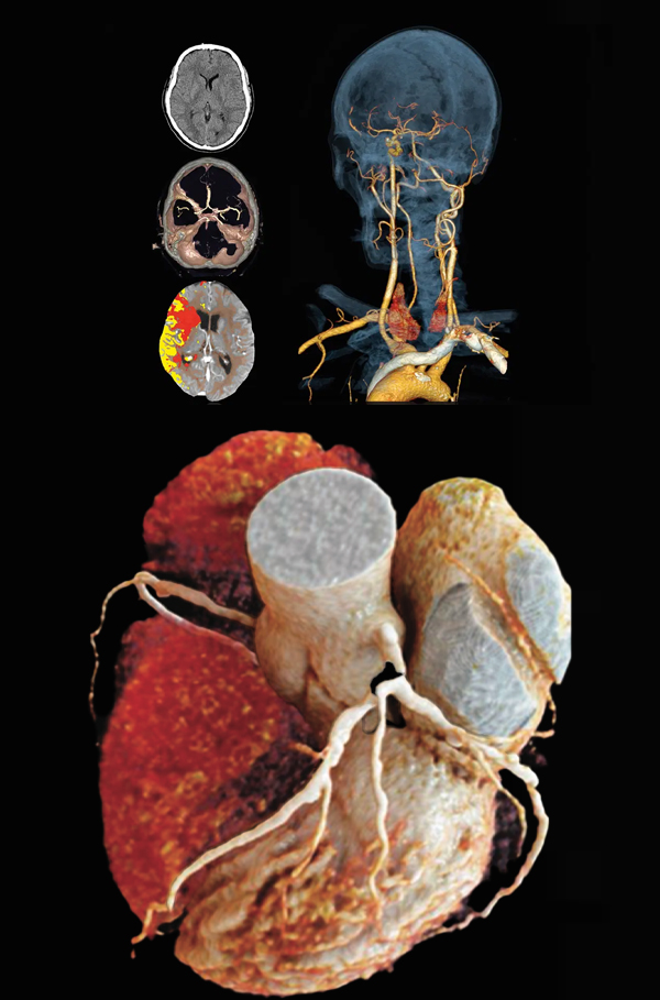 Diagnostic CT images