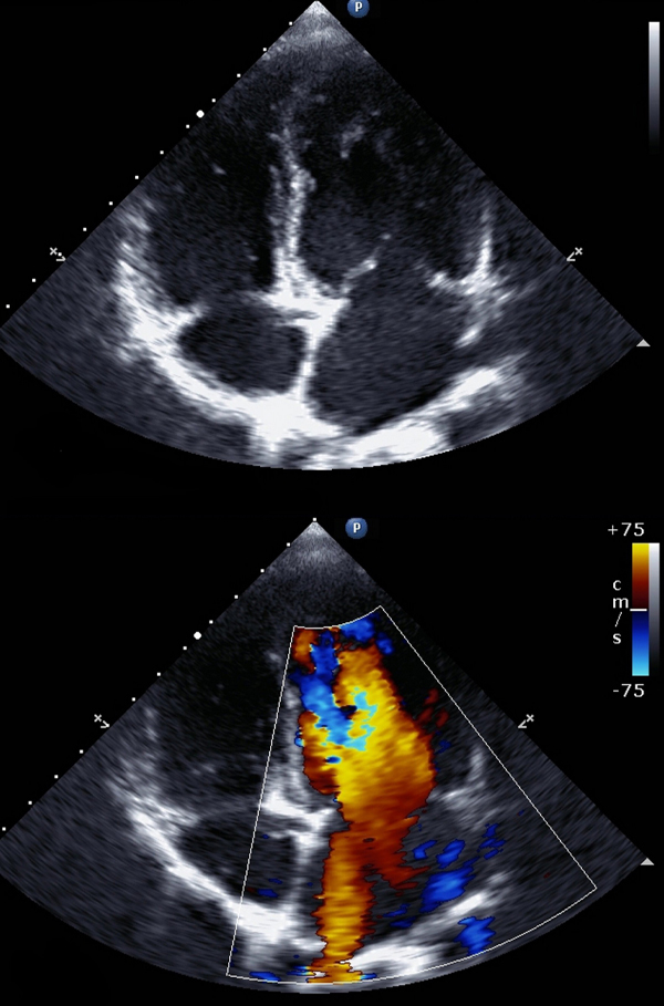 Echocardiogram exam