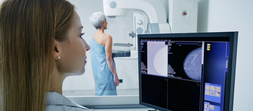 3D mammography at Zwanger-Pesiri