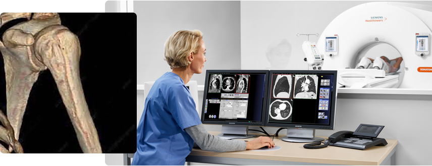 CT lung screening exam