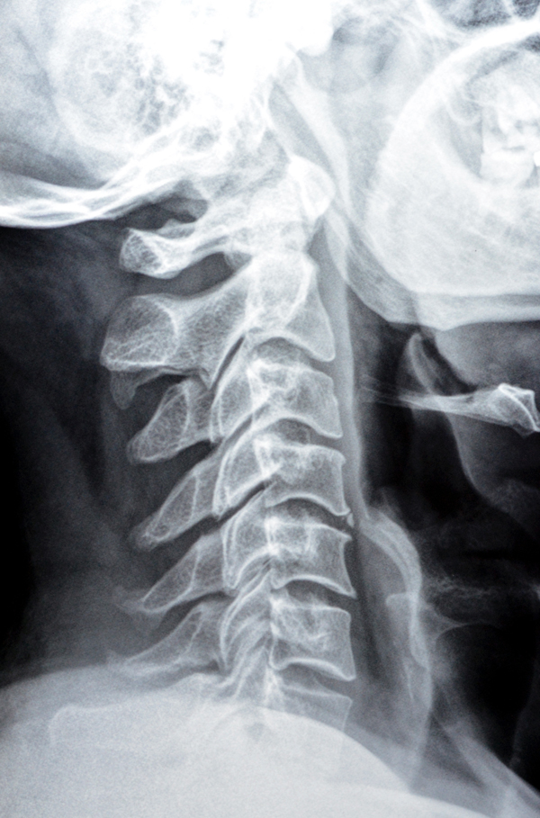 X-ray exam of the neck
