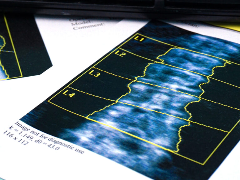 Lindenhurst ZwangerPesiri Radiology