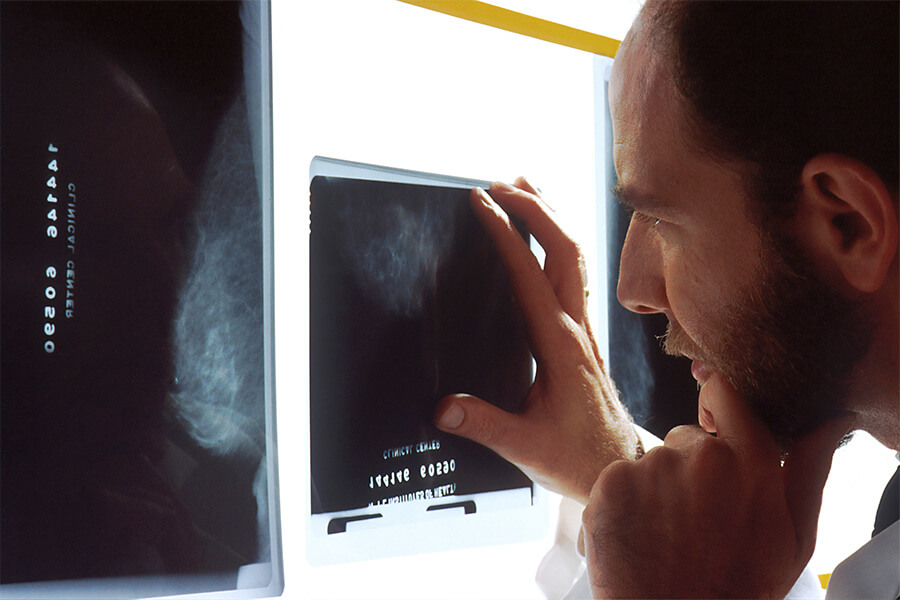 3D Mammography