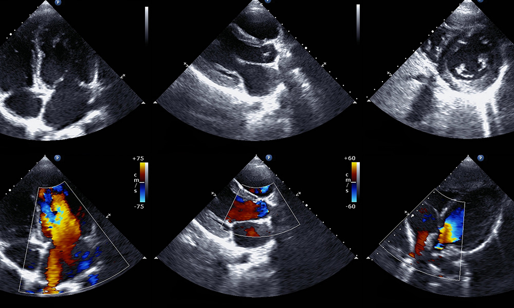 ecg 1