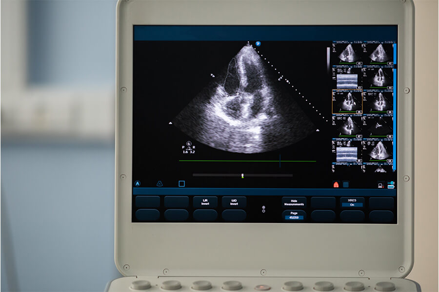ultrasound display screen