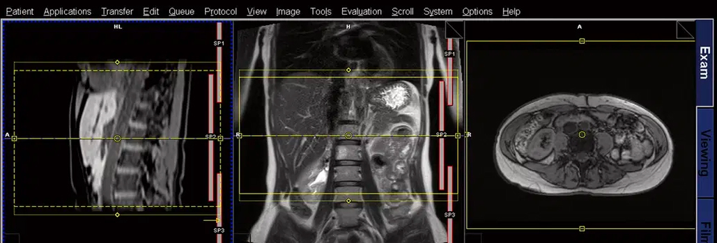 abmri-1