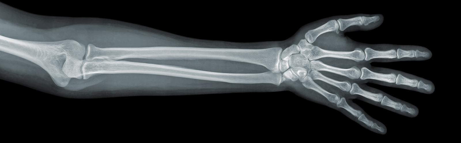 arm-xray
