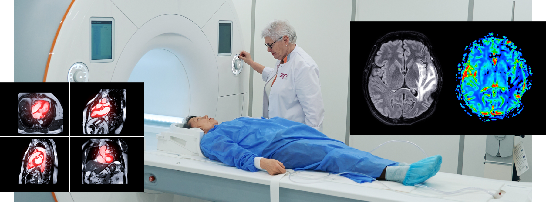 mri-images