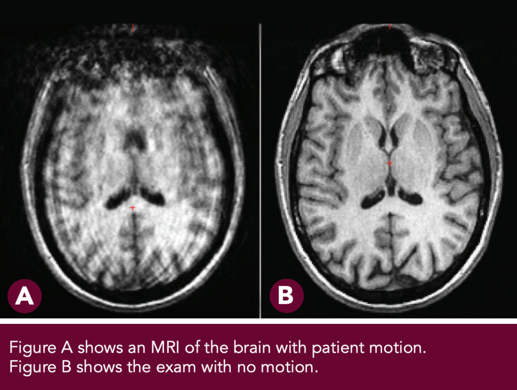 IV Sedation for MRI ZwangerPesiri Radiology